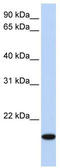 Homeobox even-skipped homolog protein 2 antibody, TA344364, Origene, Western Blot image 