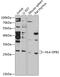 HLA class II histocompatibility antigen, DP beta 1 chain antibody, 14-910, ProSci, Western Blot image 