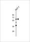 Apurinic/Apyrimidinic Endodeoxyribonuclease 2 antibody, 63-726, ProSci, Western Blot image 