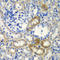 DEAD-Box Helicase 1 antibody, LS-C334363, Lifespan Biosciences, Immunohistochemistry paraffin image 