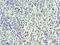 Vascular Endothelial Growth Factor C antibody, A51773-100, Epigentek, Immunohistochemistry paraffin image 