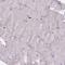 CD163 antibody, HPA046404, Atlas Antibodies, Immunohistochemistry frozen image 