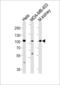 Nuclear Receptor Coactivator 7 antibody, LS-C164780, Lifespan Biosciences, Western Blot image 