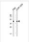 Tyrosyl-TRNA Synthetase 2 antibody, 63-230, ProSci, Western Blot image 