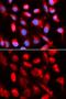 Uroporphyrinogen Decarboxylase antibody, GTX16432, GeneTex, Immunofluorescence image 