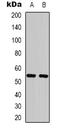 Keratin 8 antibody, LS-B16514, Lifespan Biosciences, Western Blot image 