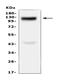 Collagen alpha-1(XVII) chain antibody, A03031-1, Boster Biological Technology, Western Blot image 