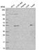 ETS Proto-Oncogene 1, Transcription Factor antibody, HPA063230, Atlas Antibodies, Western Blot image 