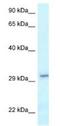 Vesicle Transport Through Interaction With T-SNAREs 1B antibody, NBP1-79902, Novus Biologicals, Western Blot image 
