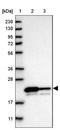 Gamma-Glutamylcyclotransferase antibody, NBP1-86728, Novus Biologicals, Western Blot image 