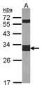 Tyrosine 3-Monooxygenase/Tryptophan 5-Monooxygenase Activation Protein Zeta antibody, NBP1-31325, Novus Biologicals, Western Blot image 