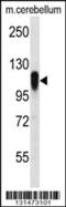 F-Box Protein 41 antibody, 56-522, ProSci, Western Blot image 