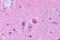 Neuropeptide Y Receptor Y5 antibody, GTX71113, GeneTex, Immunohistochemistry paraffin image 