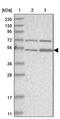 Zinc Finger Protein 69 antibody, PA5-55696, Invitrogen Antibodies, Western Blot image 