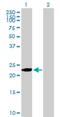 Bridging Integrator 3 antibody, H00055909-B01P, Novus Biologicals, Western Blot image 