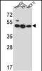 Lipase Family Member J antibody, PA5-48361, Invitrogen Antibodies, Western Blot image 