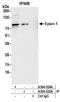 Epsin 1 antibody, A304-524A, Bethyl Labs, Immunoprecipitation image 