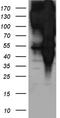Epidermal Growth Factor Receptor Pathway Substrate 15 antibody, TA890119S, Origene, Western Blot image 