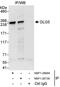 Discs Large MAGUK Scaffold Protein 5 antibody, NBP1-28694, Novus Biologicals, Immunoprecipitation image 