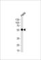 DEAD-Box Helicase 6 antibody, LS-C167342, Lifespan Biosciences, Western Blot image 