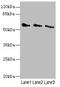 Cholinergic Receptor Nicotinic Gamma Subunit antibody, orb41486, Biorbyt, Western Blot image 