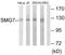 Protein SMG7 antibody, LS-C119181, Lifespan Biosciences, Western Blot image 
