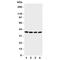 Eukaryotic translation initiation factor 2 subunit 2 antibody, R31277, NSJ Bioreagents, Western Blot image 