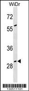 Growth Arrest Specific 2 antibody, 60-198, ProSci, Western Blot image 