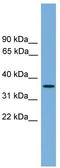 Sprouty RTK Signaling Antagonist 4 antibody, TA339762, Origene, Western Blot image 