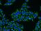 Serine hydroxymethyltransferase, cytosolic antibody, 14149-1-AP, Proteintech Group, Immunofluorescence image 