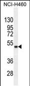 Fibronectin Type III Domain Containing 8 antibody, PA5-48190, Invitrogen Antibodies, Western Blot image 