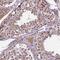 Fem-1 Homolog B antibody, PA5-59787, Invitrogen Antibodies, Immunohistochemistry frozen image 