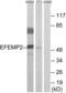 EGF Containing Fibulin Extracellular Matrix Protein 2 antibody, LS-B11747, Lifespan Biosciences, Western Blot image 