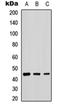 Beta-1,4-Galactosyltransferase 2 antibody, orb235035, Biorbyt, Western Blot image 