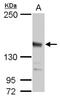 Jumonji And AT-Rich Interaction Domain Containing 2 antibody, PA5-78031, Invitrogen Antibodies, Western Blot image 