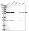 Heterogeneous Nuclear Ribonucleoprotein K antibody, NBP2-58067, Novus Biologicals, Western Blot image 