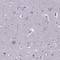 Engrailed Homeobox 1 antibody, NBP2-57757, Novus Biologicals, Immunohistochemistry frozen image 