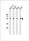 Natural Killer Cell Cytotoxicity Receptor 3 Ligand 1 antibody, PA5-49085, Invitrogen Antibodies, Western Blot image 