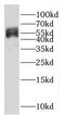 Glucose-6-phosphate 1-dehydrogenase antibody, FNab03269, FineTest, Western Blot image 