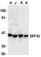DNA Fragmentation Factor Subunit Alpha antibody, PA1-33021, Invitrogen Antibodies, Western Blot image 