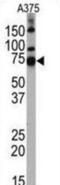 Histone Deacetylase 10 antibody, abx026088, Abbexa, Western Blot image 