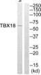 T-Box 18 antibody, PA5-39491, Invitrogen Antibodies, Western Blot image 