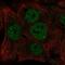 hINO80 antibody, NBP2-58955, Novus Biologicals, Immunocytochemistry image 