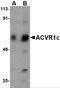 Activin A Receptor Type 1C antibody, 4795, ProSci, Western Blot image 