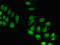 Ribosomal Protein L23a antibody, LS-C679349, Lifespan Biosciences, Immunofluorescence image 