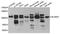 Neuroligin 4 Y-Linked antibody, A4513, ABclonal Technology, Western Blot image 