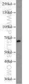 Sperm-associated antigen 8 antibody, 13915-1-AP, Proteintech Group, Western Blot image 