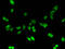 Metallothionein 1E antibody, A57577-100, Epigentek, Immunofluorescence image 