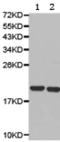 Potassium Voltage-Gated Channel Subfamily E Regulatory Subunit 1 antibody, TA321082, Origene, Western Blot image 