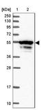 Meis Homeobox 3 antibody, NBP2-14230, Novus Biologicals, Western Blot image 
